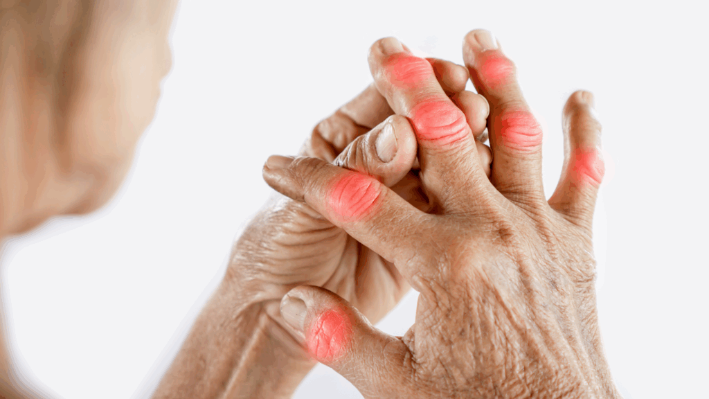 Cannabis and Inflammation: Could CBD and Microdosing THC Help?